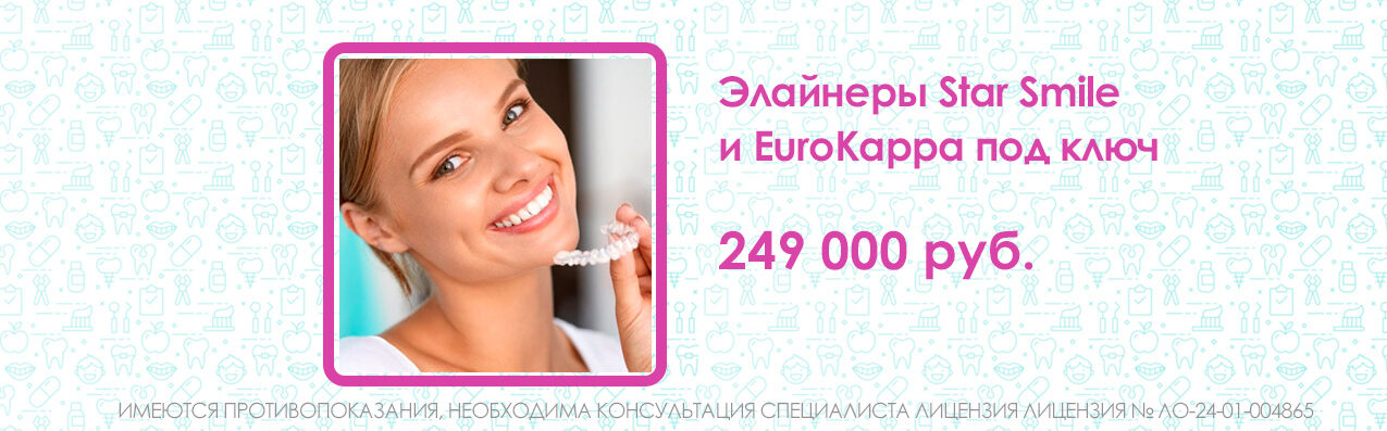 Элайнеры Star Smile и EuroKappa под ключ 249 000 рублей