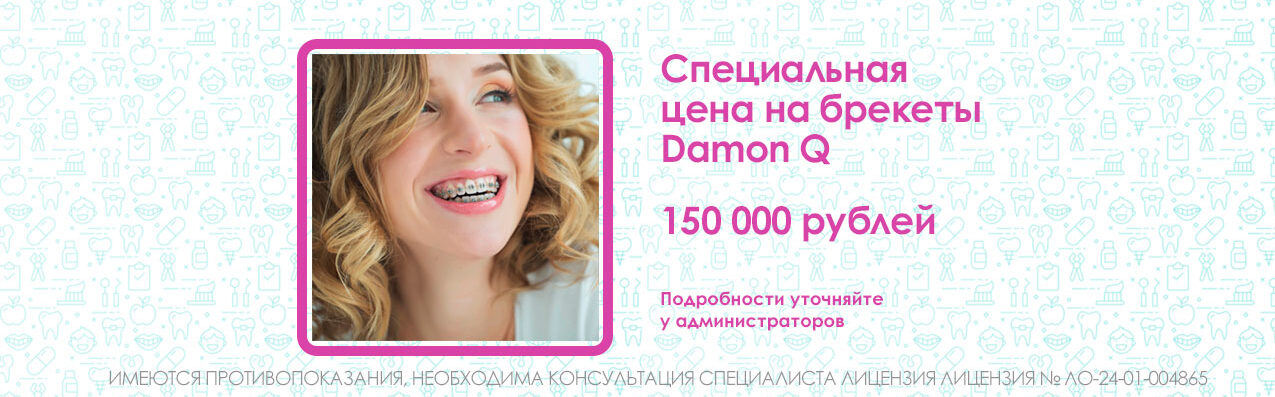 Специальная цена на брекеты Damon Q 150 000 рублей